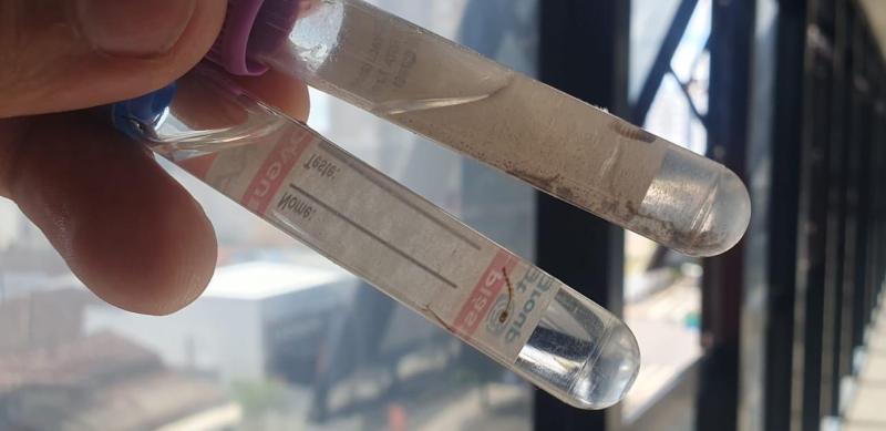 Novo LIRAa aponta média infestação para o Aedes aegypti em Araxá