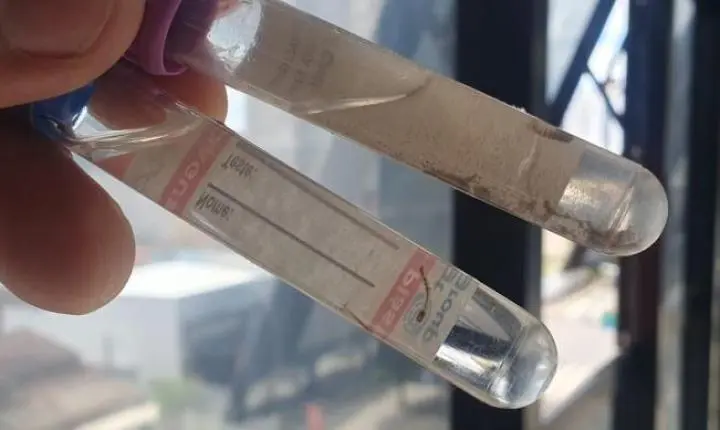 Novo LIRAa aponta média infestação para o Aedes aegypti em Araxá